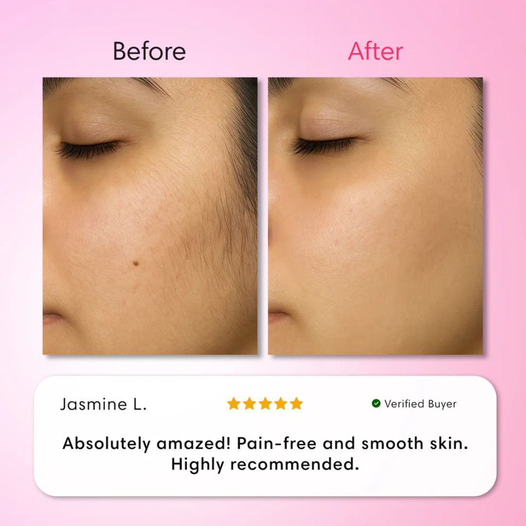 ENVO™ ClearSkin Trio