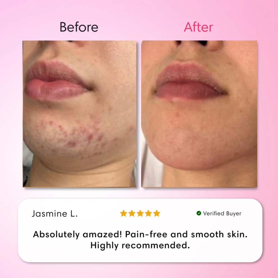 ENVO™ ClearSkin Trio