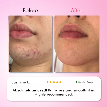 ENVO™ ClearSkin Trio