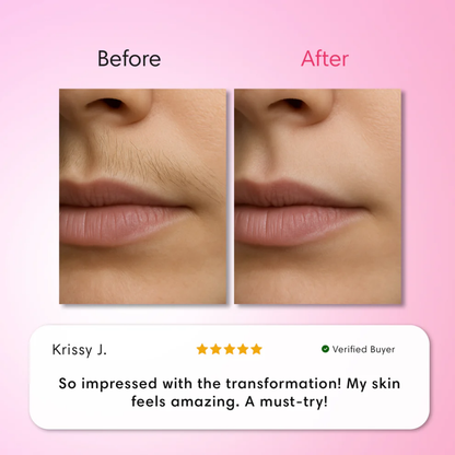 ENVO™ ClearSkin Trio